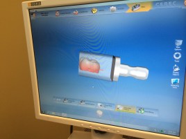 Computer placing crown within blank